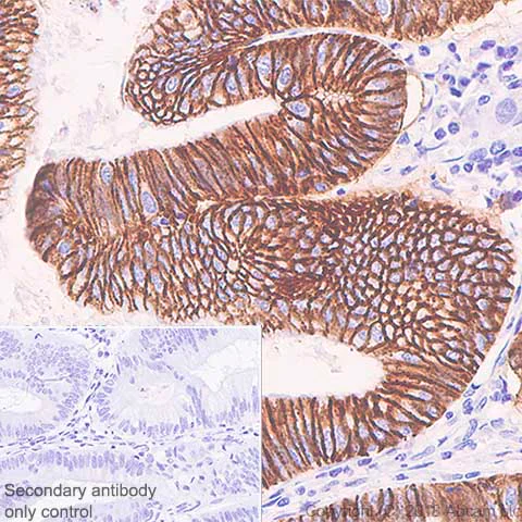 Immunohistochemistry (Formalin/PFA-fixed paraffin-embedded sections) - Anti-LI Cadherin antibody [SP183] - BSA and Azide free (AB240266)