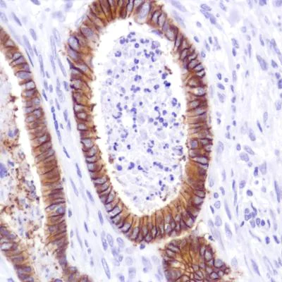 Immunohistochemistry (Formalin/PFA-fixed paraffin-embedded sections) - Anti-LI Cadherin antibody [SP183] - C-terminal (AB183318)