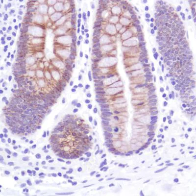 Immunohistochemistry (Formalin/PFA-fixed paraffin-embedded sections) - Anti-LI Cadherin antibody [SP183] - C-terminal (AB183318)
