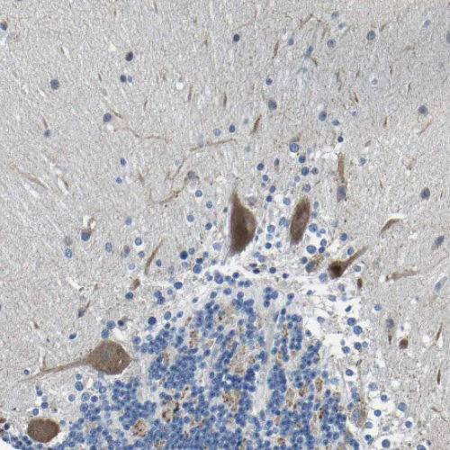 Immunohistochemistry (Formalin/PFA-fixed paraffin-embedded sections) - Anti-LIAS antibody (AB246917)