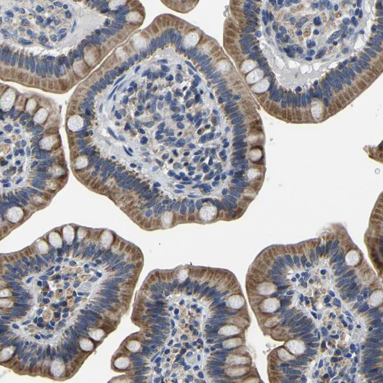 Immunohistochemistry (Formalin/PFA-fixed paraffin-embedded sections) - Anti-LIAS antibody (AB246917)