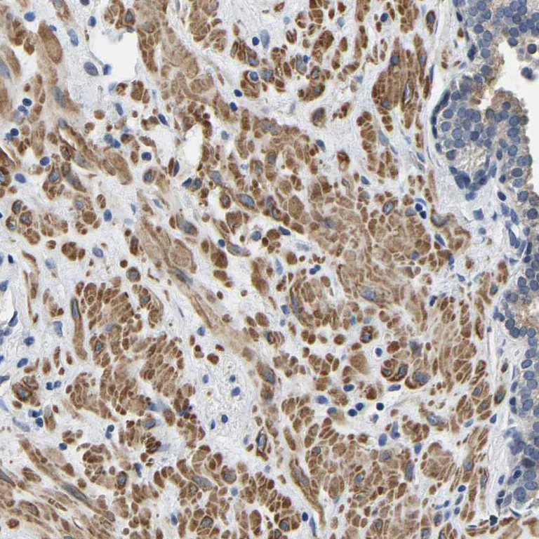 Immunohistochemistry (Formalin/PFA-fixed paraffin-embedded sections) - Anti-LIAS antibody (AB246917)