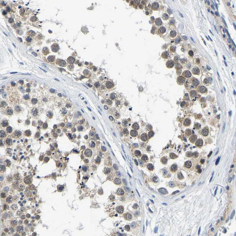 Immunohistochemistry (Formalin/PFA-fixed paraffin-embedded sections) - Anti-LIAS antibody (AB246917)