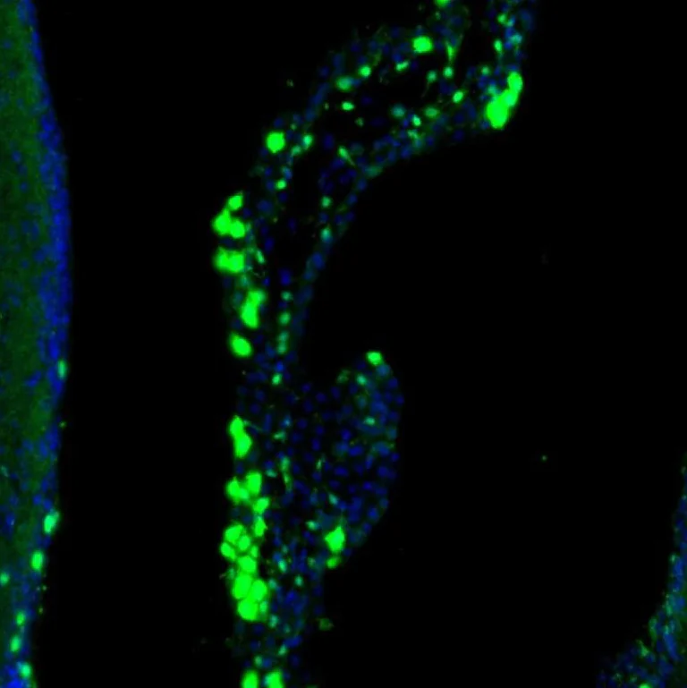 Immunohistochemistry (Formalin/PFA-fixed paraffin-embedded sections) - Anti-LIAS antibody (AB246917)