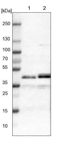 Western blot - Anti-LIAS antibody (AB246917)