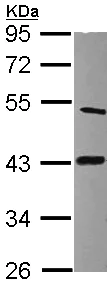 Western blot - Anti-LIAS antibody (AB96302)
