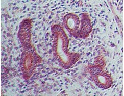 Immunohistochemistry (Formalin/PFA-fixed paraffin-embedded sections) - Anti-LIF antibody [39N7D10] (AB138002)