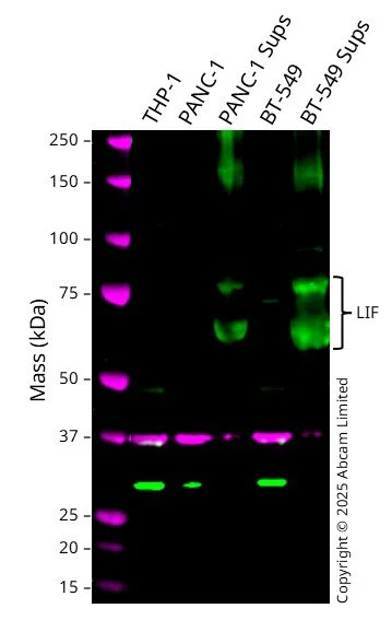 Western blot - Anti-LIF antibody [39N7D10] (AB138002)