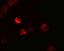 Immunocytochemistry/ Immunofluorescence - Anti-LIF antibody (AB113262), expandable thumbnail