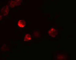 Immunocytochemistry/ Immunofluorescence - Anti-LIF antibody (AB113262)