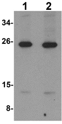Western blot - Anti-LIF antibody (AB113262), expandable thumbnail