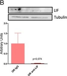 Western blot - Anti-LIF antibody (AB113262), expandable thumbnail