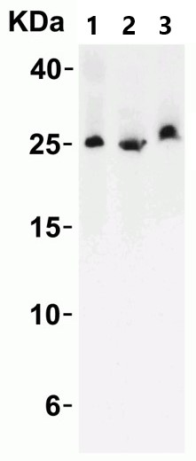 Western blot - Anti-LIF antibody (AB113262), expandable thumbnail