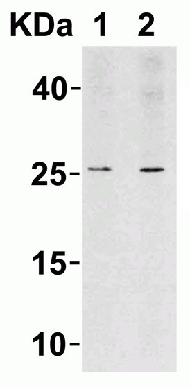 Western blot - Anti-LIF antibody (AB113262), expandable thumbnail