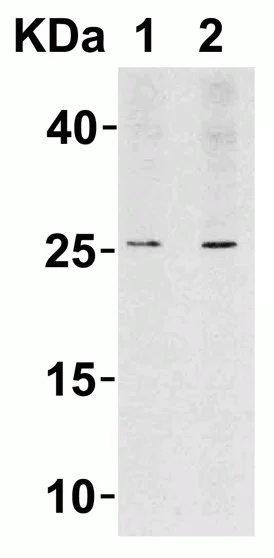 Western blot - Anti-LIF antibody (AB113262)