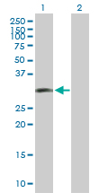 Western blot - Anti-LIF antibody (AB172023), expandable thumbnail