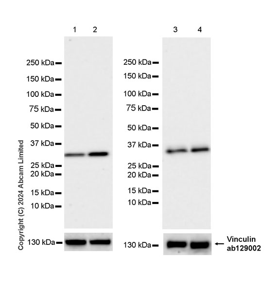 Western blot - Anti-LIF antibody [EPR28693-84] - BSA and Azide free (AB320822), expandable thumbnail