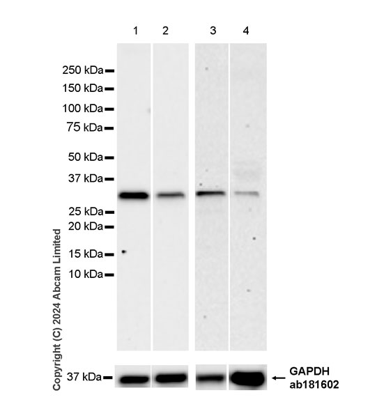 Western blot - Anti-LIF antibody [EPR28693-84] - BSA and Azide free (AB320822), expandable thumbnail