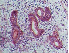 Immunohistochemistry (Formalin/PFA-fixed paraffin-embedded sections) - Anti-LIF antibody [IMG39N7D10] (AB138002)