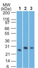 Western blot - Anti-LIF antibody [IMG39N7D10] (AB138002), expandable thumbnail