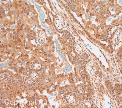 Immunohistochemistry (Formalin/PFA-fixed paraffin-embedded sections) - Anti-LIFR antibody (AB101228), expandable thumbnail