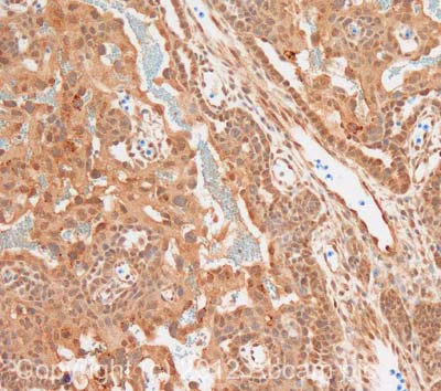 Immunohistochemistry (Formalin/PFA-fixed paraffin-embedded sections) - Anti-LIFR antibody (AB101228)