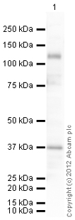 Western blot - Anti-LIFR antibody (AB101228), expandable thumbnail
