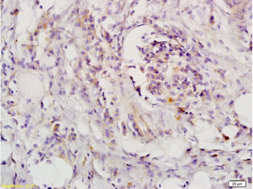 Immunohistochemistry (Formalin/PFA-fixed paraffin-embedded sections) - Anti-LIFR antibody (AB202847), expandable thumbnail