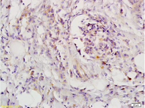 Immunohistochemistry (Formalin/PFA-fixed paraffin-embedded sections) - Anti-LIFR antibody (AB202847)