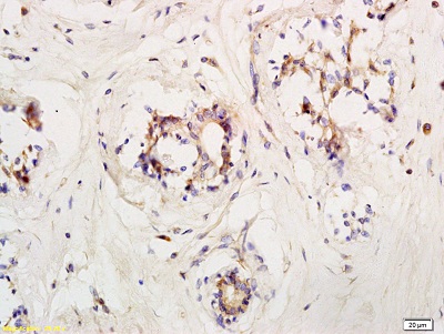 Immunohistochemistry (Formalin/PFA-fixed paraffin-embedded sections) - Anti-LIFR antibody (AB202847), expandable thumbnail