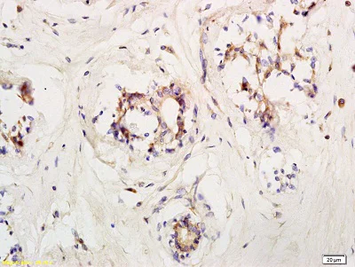 Immunohistochemistry (Formalin/PFA-fixed paraffin-embedded sections) - Anti-LIFR antibody (AB202847)