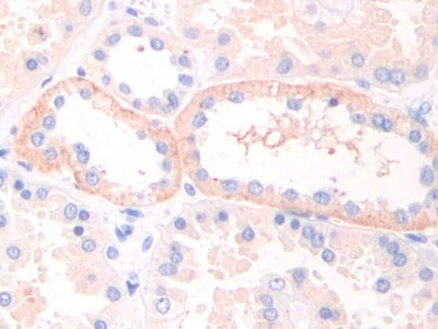 Immunohistochemistry (Formalin/PFA-fixed paraffin-embedded sections) - Anti-LIFR antibody (AB232877)