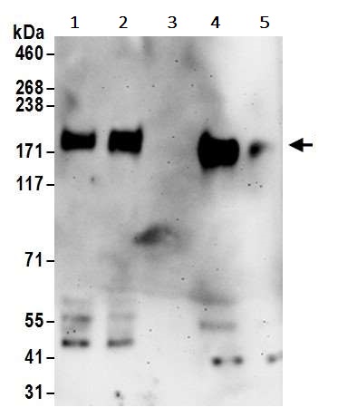 Western blot - Anti-LIFR antibody (AB245525)