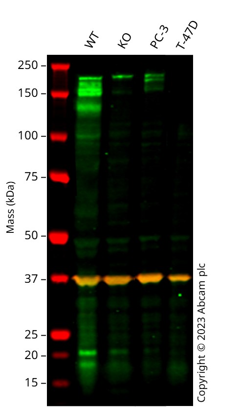 Western blot - Anti-LIFR antibody [EPR24651-109] (AB283651)