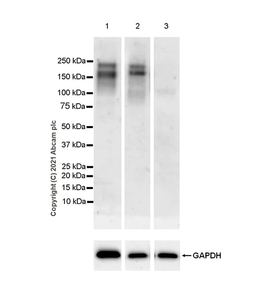 Western blot - Anti-LIFR antibody [EPR24651-109] - BSA and Azide free (AB283662)