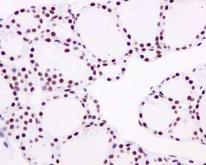 Immunohistochemistry (Formalin/PFA-fixed paraffin-embedded sections) - Anti-LIG1 antibody [EPR12464] (AB177946)