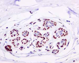 Immunohistochemistry (Formalin/PFA-fixed paraffin-embedded sections) - Anti-LIG1 antibody [EPR12464] (AB177946)