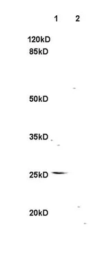 Western blot - Anti-LIGHT/TNFSF14 antibody (AB203578)