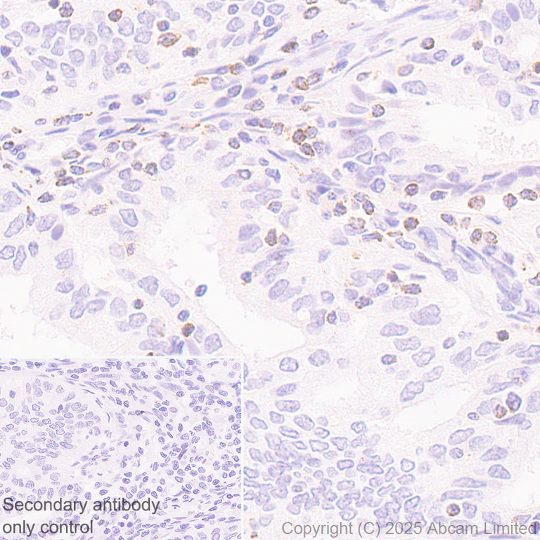 Immunohistochemistry (Formalin/PFA-fixed paraffin-embedded sections) - Anti-LIGHT/TNFSF14 antibody [EPR29031-53] (AB323382)