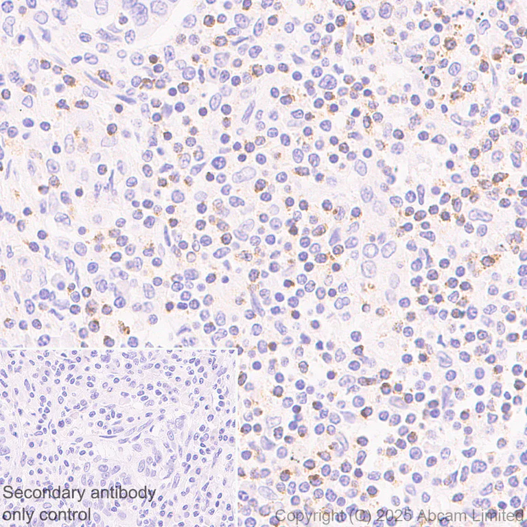 Immunohistochemistry (Formalin/PFA-fixed paraffin-embedded sections) - Anti-LIGHT/TNFSF14 antibody [EPR29031-53] (AB323382)