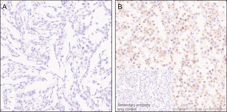 Immunohistochemistry (Formalin/PFA-fixed paraffin-embedded sections) - Anti-LIGHT/TNFSF14 antibody [EPR29031-53] (AB323382)
