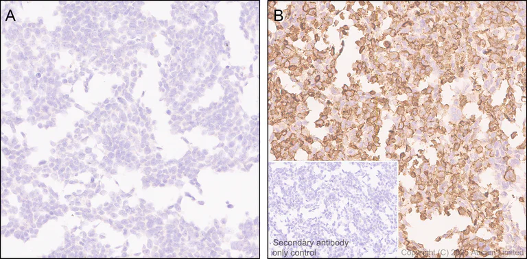 Immunohistochemistry (Formalin/PFA-fixed paraffin-embedded sections) - Anti-LIGHT/TNFSF14 antibody [EPR29031-53] (AB323382)