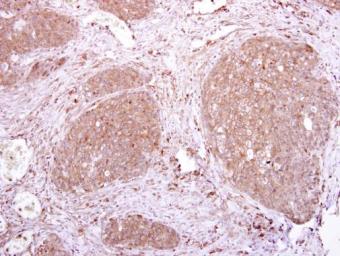 Immunohistochemistry (Formalin/PFA-fixed paraffin-embedded sections) - Anti-LILRA3 antibody (AB111562)