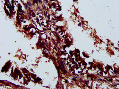 Immunohistochemistry (Formalin/PFA-fixed paraffin-embedded sections) - Anti-LILRA3 antibody (AB235108)