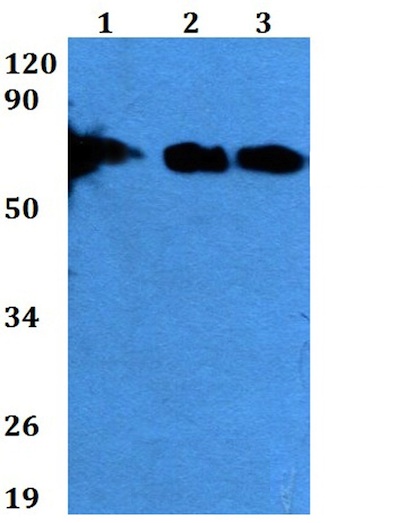 Western blot - Anti-LILRB1 antibody (AB200648)