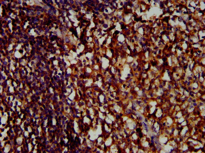 Immunohistochemistry (Formalin/PFA-fixed paraffin-embedded sections) - Anti-LILRB1 antibody (AB237625)