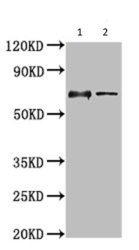 Western blot - Anti-LILRB1 antibody (AB237625), expandable thumbnail