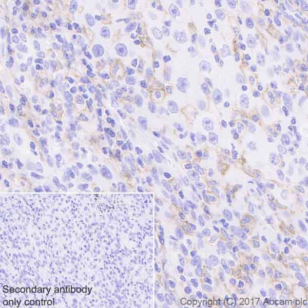 Immunohistochemistry (Formalin/PFA-fixed paraffin-embedded sections) - Anti-LILRB1 antibody [EPR21007] (AB229186)