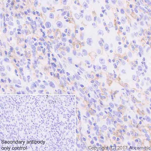 Immunohistochemistry (Formalin/PFA-fixed paraffin-embedded sections) - Anti-LILRB1 antibody [EPR21007] - BSA and Azide free (AB229853)