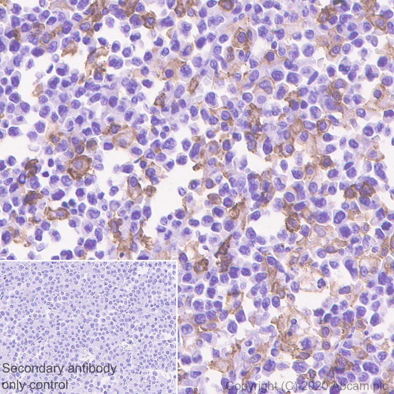 Immunohistochemistry (Formalin/PFA-fixed paraffin-embedded sections) - Anti-LILRB3 antibody [FRAS92B] - BSA and Azide free (AB271297)